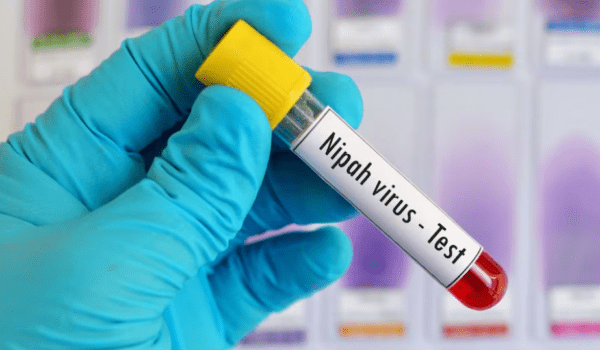 Nipah situation stable in Kozhikode with no new cases reported so far