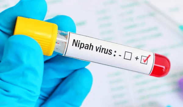 Suspected Nipah case reported in Kozhikode; health authorities intensify surveillance.